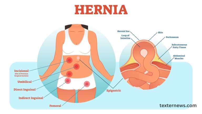 Life-Threatening Internal Hernia With Closed-Loop Obstruction Case